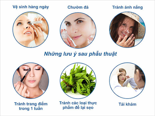 Những lưu ý sau khi cắt mí mắt