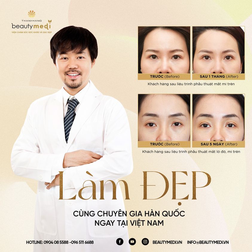 Bác sĩ Kim In Chul là lựa chọn hàng đầu của nhiều khách hàng Việt khi có nhu cầu làm đẹp mắt 