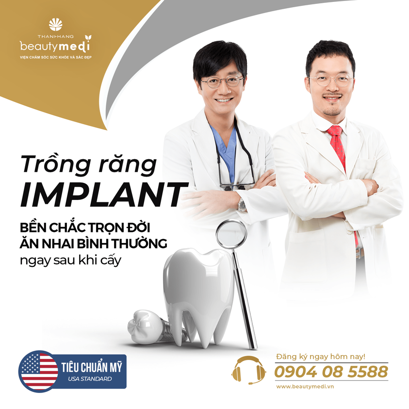 Trồng Implant được thực hiện bằng kỹ thuật hiện đại theo công nghệ và tiêu chuẩn Hoa Kỳ  