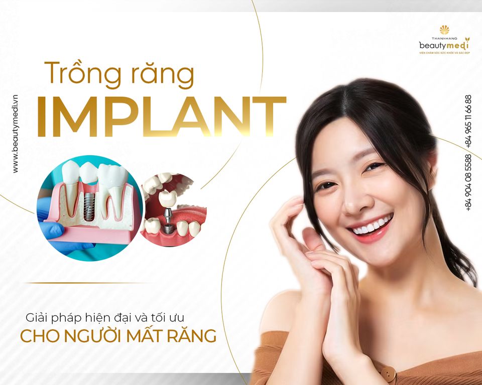 Phương pháp cấy ghép implant ở Thanh Hằng Beauty Medi được thực hiện bằng kỹ thuật hiện đại