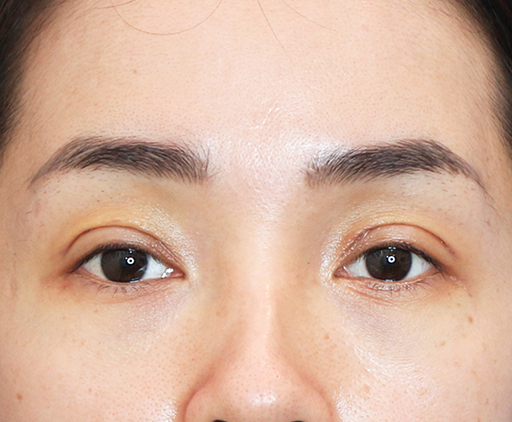 image_after