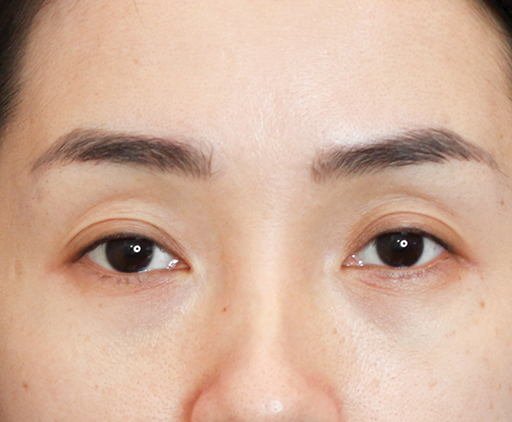 image_before