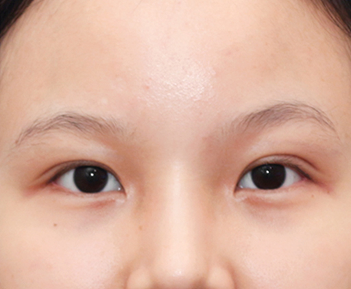 image_after