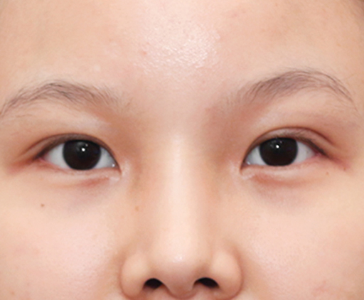 image_after