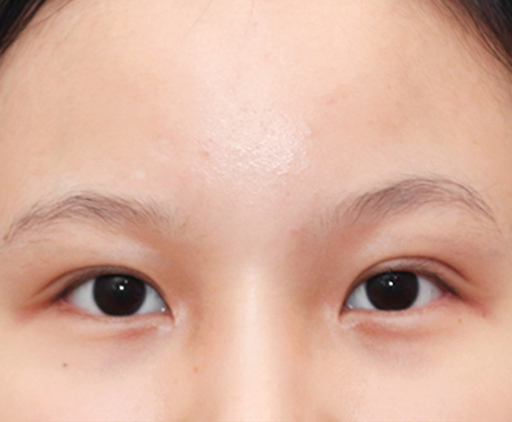 image_after