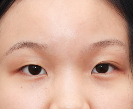 image_before