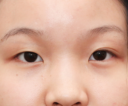 image_before