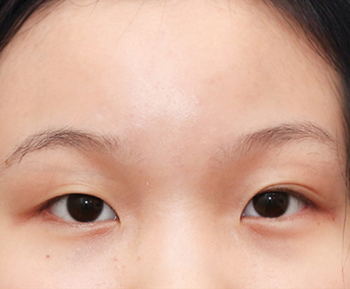 image_before