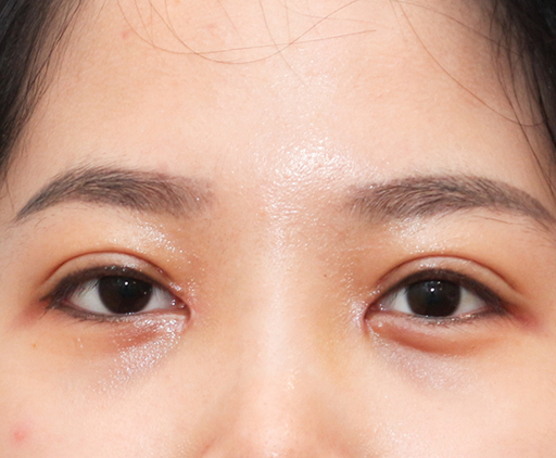 image_after