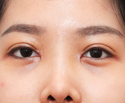 image_after