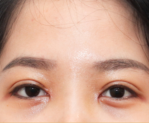 image_after
