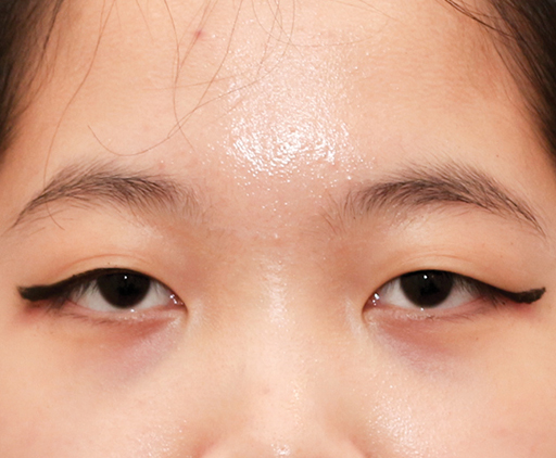 image_before