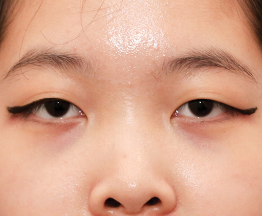 image_before