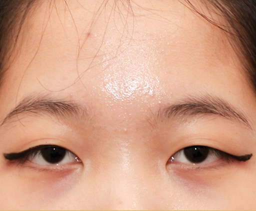 image_before