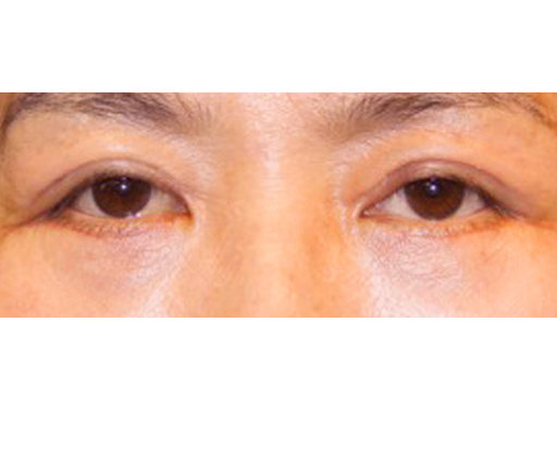image_after