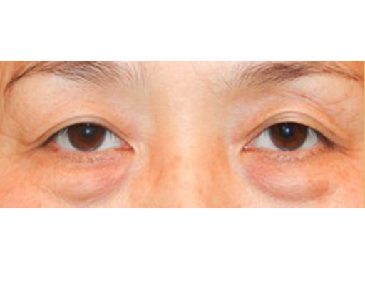 image_before