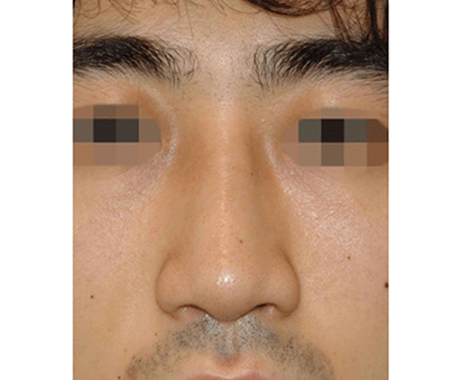 image_after
