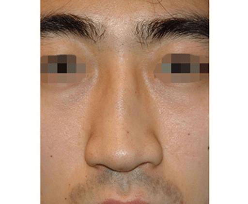 image_before