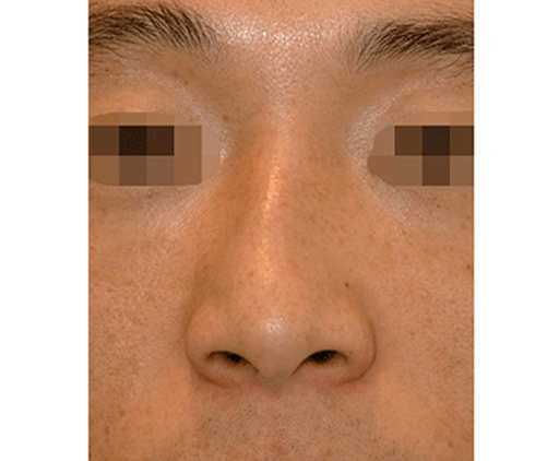 image_before