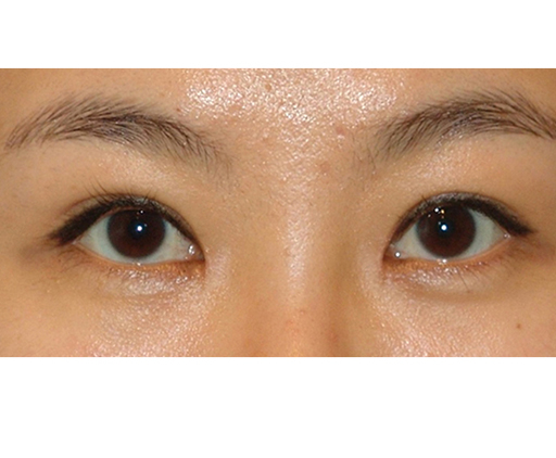 image_after