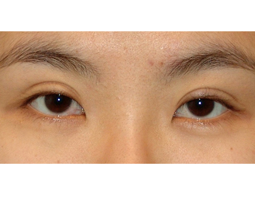 image_before
