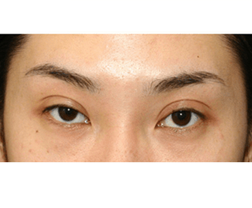 image_before
