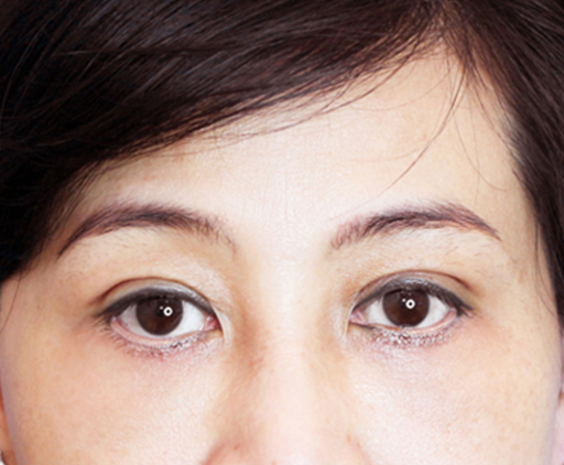 image_after