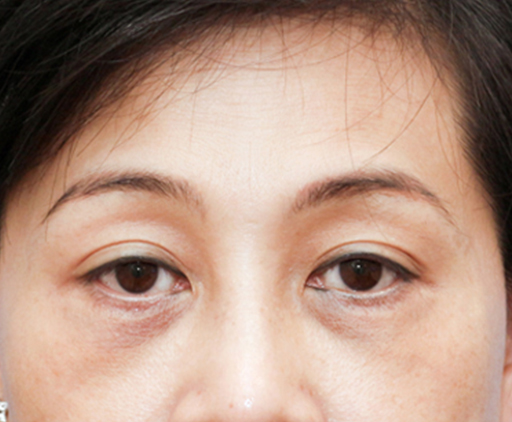 image_before