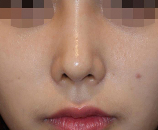 image_after