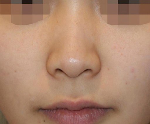 image_before