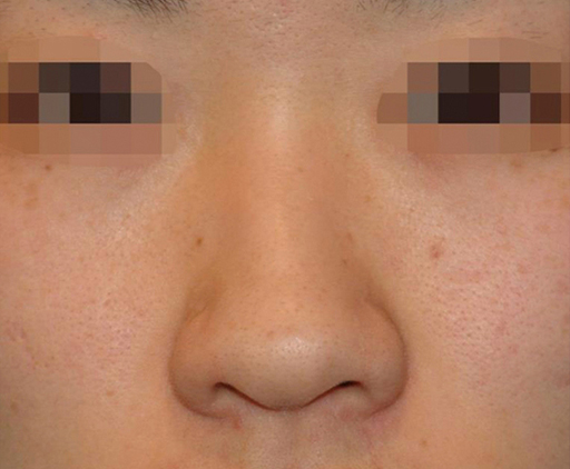 image_before