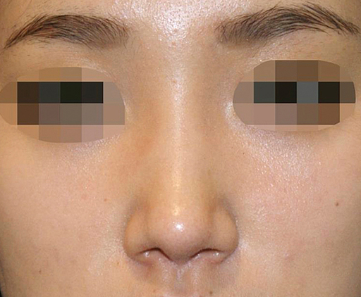 image_after