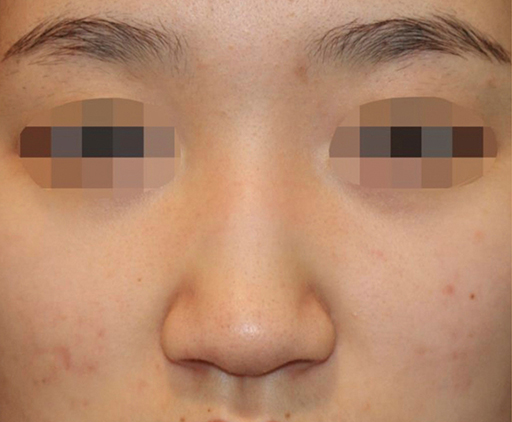 image_before