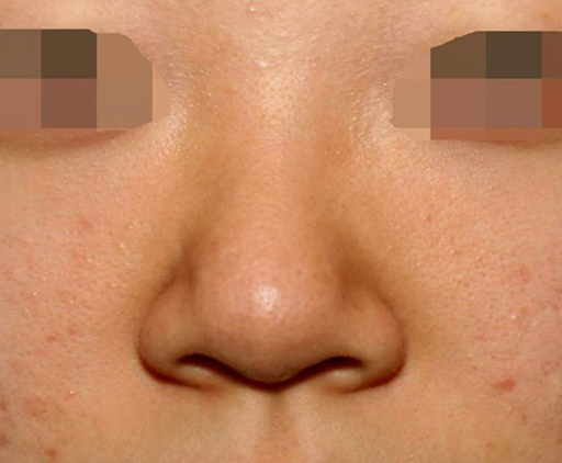 image_before