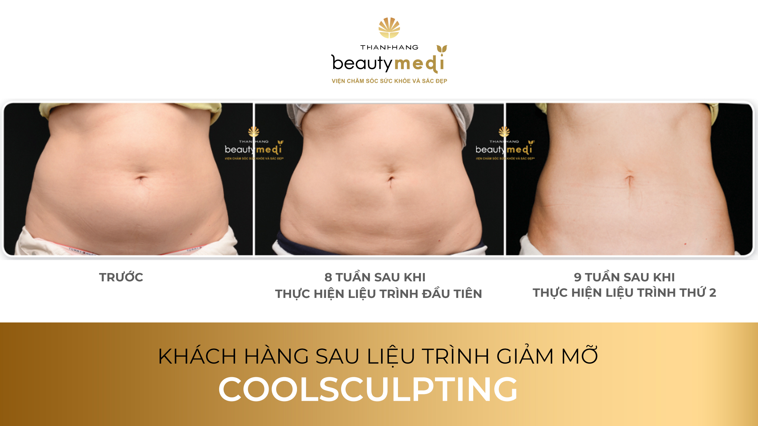 coolsculpting