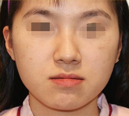 image_before