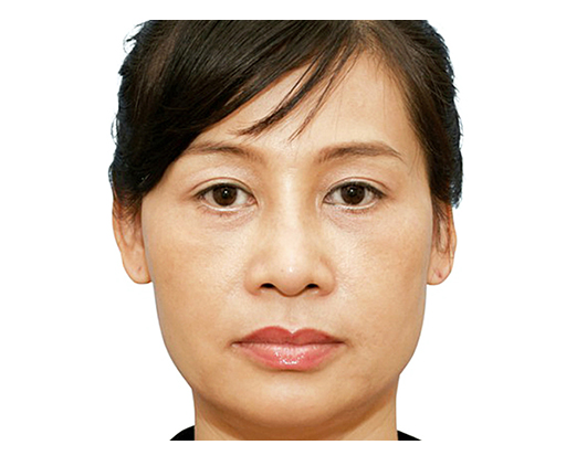 image_after
