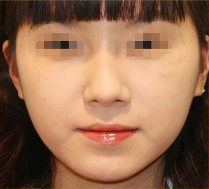 image_after