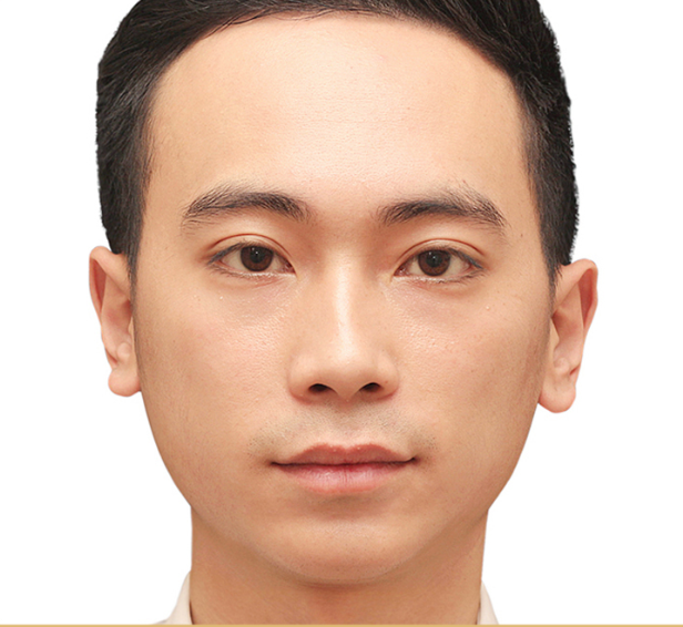 image_after