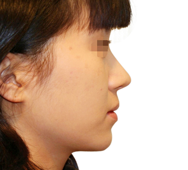 image_after