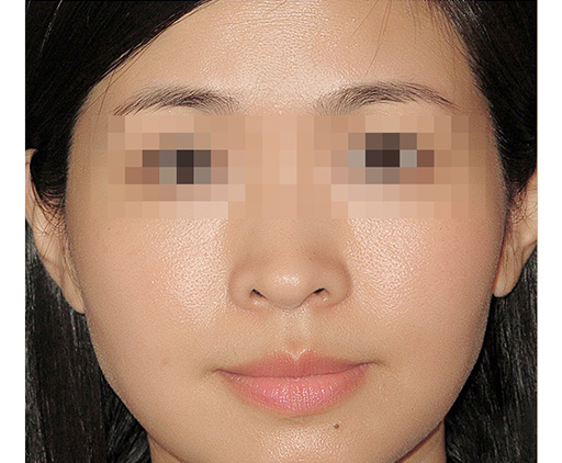 image_after