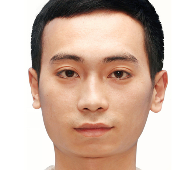 image_before