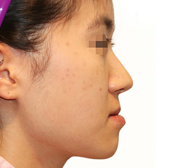 image_before