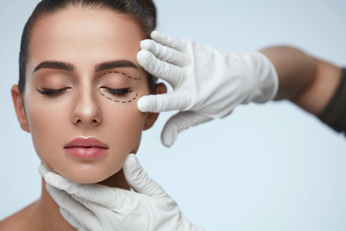 Định hình vị trí phẫu thuật bóc mỡ mắt
