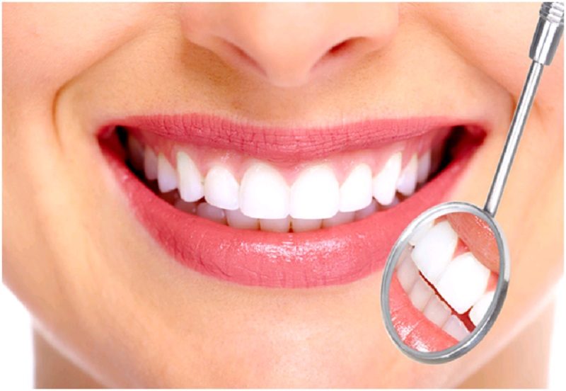 Tình trạng răng miệng hư tổn mức độ nhẹ đều có thể đi bọc răng sứ thẩm mỹ