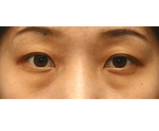 image_before