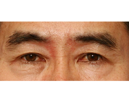 image_after
