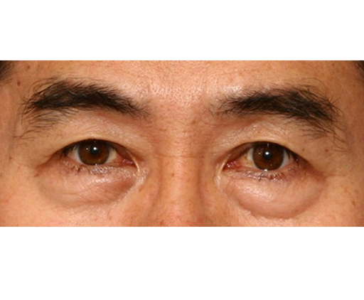image_before