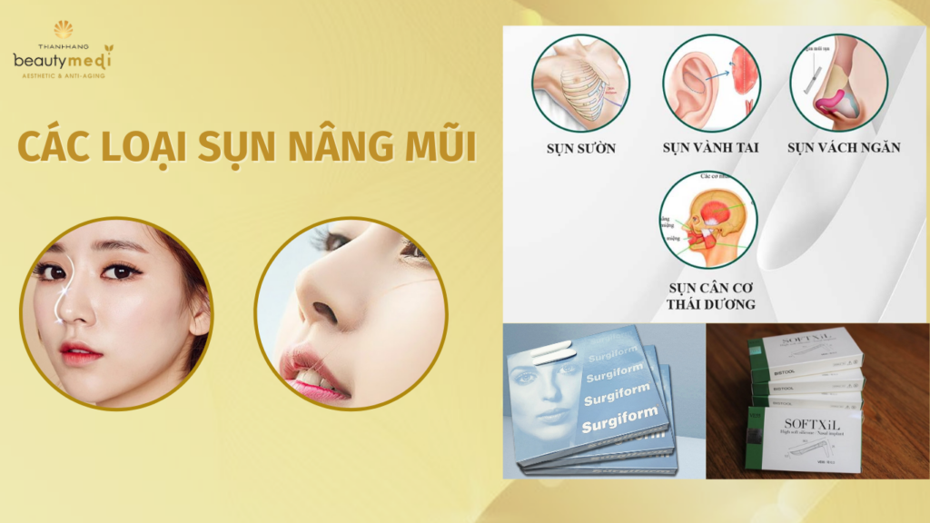 các loại sụn nâng mũi