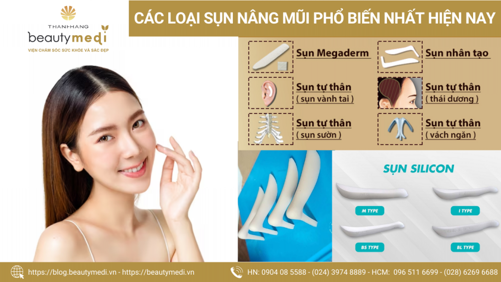 Các loại sụn nâng mũi hiện nay